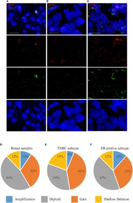 BPTF promotes the progression of distinct subtypes of breast cancer and is a therapeutic target